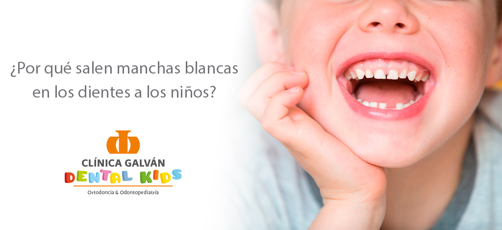 ¿Por qué salen manchas blancas en los dientes a los niños?
